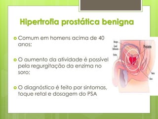 Hipertrofia prostática benigna 
 Comum em homens acima de 40 
anos; 
 O aumento da atividade é possível 
pela regurgitação da enzima no 
soro; 
 O diagnóstico é feito por sintomas, 
toque retal e dosagem do PSA 
 