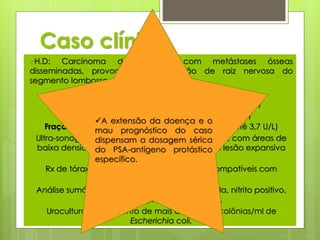 Caso clínico 
H.D: Carcinoma de próstata com metástases ósseas 
disseminadas, provocando compressão de raiz nervosa do 
segmento lombossacro, a partir de L3. 
Exames solicitados: 
Fosfatase alcalina sérica = 200 U/L (N = até 170 U/L) 
Fosfatase ácida sérica = 20 U/L (N= até 13 U/L) 
A extensão da doença e o 
mau prognóstico do caso 
dispensam a dosagem sérica 
do PSA-antígeno protástico 
específico. 
Fração prostática da fosfatase ácida = 5 U/L (N= até 3,7 U/L) 
Ultra-sonografia: próstata aumentada de volume, com áreas de 
baixa densidade ecográfica, compatíveis com lesão expansiva 
sólida. 
Rx de tórax e bacia: lesões osteoblásticas compatíveis com 
metástases. 
Análise sumário de urina: densidade aumentada, nitrito positivo, 
proteinúria, piúria e bacteriúria. 
Urocultura: crescimento de mais de 100.000 colônias/ml de 
Escherichia coli. 
 
