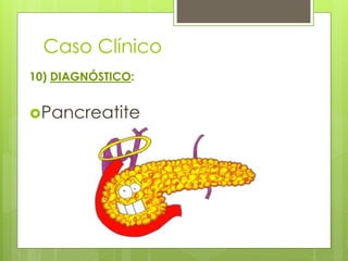 Caso Clínico 
10) DIAGNÓSTICO: 
Pancreatite 
 