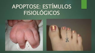 APOPTOSE: ESTÍMULOS 
FISIOLÓGICOS 
 