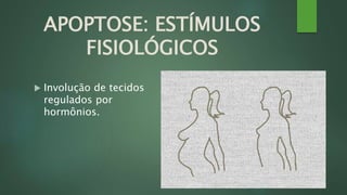 APOPTOSE: ESTÍMULOS 
FISIOLÓGICOS 
 Involução de tecidos 
regulados por 
hormônios. 
 