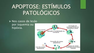 APOPTOSE: ESTÍMULOS 
PATOLÓGICOS 
 Nos casos de lesão 
por isquemia ou 
hipóxia. 
 