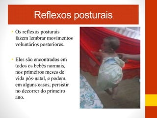 Reflexos posturais 
• Os reflexos posturais 
fazem lembrar movimentos 
voluntários posteriores. 
• Eles são encontrados em 
todos os bebês normais, 
nos primeiros meses de 
vida pós-natal, e podem, 
em alguns casos, persistir 
no decorrer do primeiro 
ano. 
 