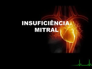 INSUFICIÊNCIA
MITRAL
 