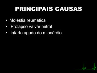 PRINCIPAIS CAUSAS
• Moléstia reumática
• Prolapso valvar mitral
• infarto agudo do miocárdio
 