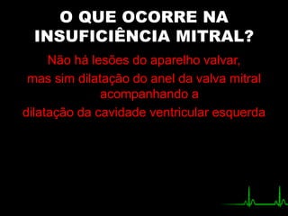 O QUE OCORRE NA
INSUFICIÊNCIA MITRAL?
Não há lesões do aparelho valvar,
mas sim dilatação do anel da valva mitral
acompanhando a
dilatação da cavidade ventricular esquerda
 