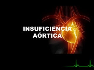 INSUFICIÊNCIA
AÓRTICA
 