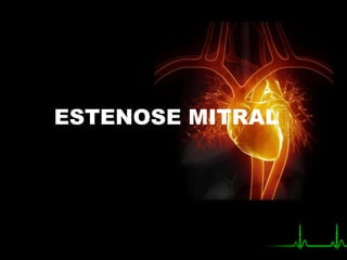 ESTENOSE MITRAL
 