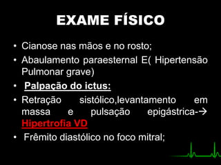 EXAME FÍSICO
• Cianose nas mãos e no rosto;
• Abaulamento paraesternal E( Hipertensão
Pulmonar grave)
• Palpação do ictus:
• Retração sistólico,levantamento em
massa e pulsação epigástrica-
Hipertrofia VD
• Frêmito diastólico no foco mitral;
 