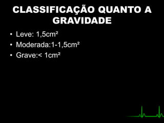 CLASSIFICAÇÃO QUANTO A
GRAVIDADE
• Leve: 1,5cm²
• Moderada:1-1,5cm²
• Grave:< 1cm²
 