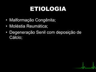 ETIOLOGIA
• Malformação Congênita;
• Moléstia Reumática;
• Degeneração Senil com deposição de
Cálcio;
 