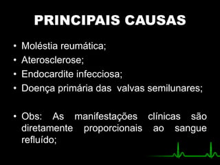 PRINCIPAIS CAUSAS
• Moléstia reumática;
• Aterosclerose;
• Endocardite infecciosa;
• Doença primária das valvas semilunares;
• Obs: As manifestações clínicas são
diretamente proporcionais ao sangue
refluído;
 