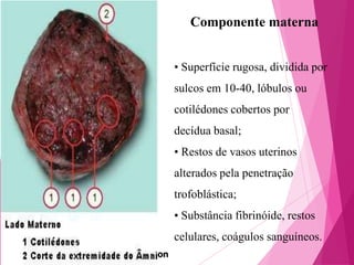 Componente materna
• Superfície rugosa, dividida por
sulcos em 10-40, lóbulos ou
cotilédones cobertos por
decídua basal;

• Restos de vasos uterinos
alterados pela penetração
trofoblástica;

• Substância fibrinóide, restos
celulares, coágulos sanguíneos.
on

 