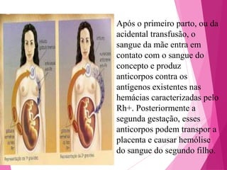Após o primeiro parto, ou da
acidental transfusão, o
sangue da mãe entra em
contato com o sangue do
concepto e produz
anticorpos contra os
antígenos existentes nas
hemácias caracterizadas pelo
Rh+. Posteriormente a
segunda gestação, esses
anticorpos podem transpor a
placenta e causar hemólise
do sangue do segundo filho.

 