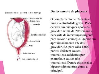 Deslocamento da placenta
O descolamento de placenta é
uma eventualidade grave. Pode
ocorrer em qualquer época da
gravidez acima da 20ª semana e
necessita de intervenção urgente
para salvar o concepto. Ocorre em
aproximadamente 1% das
gravidez, 6,5 para cada 1.000
partos. Existem causas
traumáticas, acidentes por
exemplo, e causas não
traumáticas. Dentre estas está a
hipertensão materna como a
principal.

 