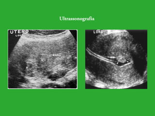 Ultrassonografia 
 