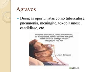 Agravos 
Doenças oportunistas como tuberculose, pneumonia, meningite, toxoplasmose, candidíase, etc.  
