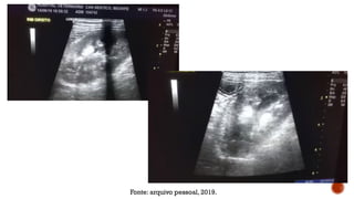 Fonte: arquivo pessoal, 2019.
 