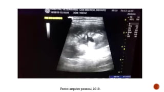 Fonte: arquivo pessoal, 2019.
 