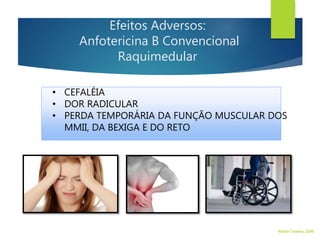 • CEFALÉIA
• DOR RADICULAR
• PERDA TEMPORÁRIA DA FUNÇÃO MUSCULAR DOS
MMII, DA BEXIGA E DO RETO
Efeitos Adversos:
Anfotericina B Convencional
Raquimedular
Walter Tavares, 2006.
 