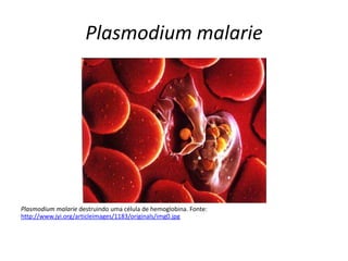 Plasmodium malarie




Plasmodium malarie destruindo uma célula de hemoglobina. Fonte:
http://www.jyi.org/articleimages/1183/originals/img0.jpg
 