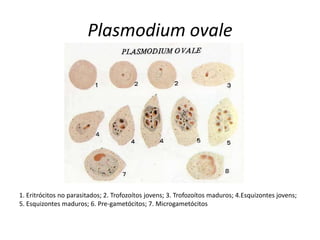 Plasmodium ovale




1. Eritrócitos no parasitados; 2. Trofozoítos jovens; 3. Trofozoítos maduros; 4.Esquizontes jovens;
5. Esquizontes maduros; 6. Pre-gametócitos; 7. Microgametócitos
 