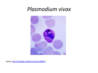 Plasmodium vivax




Fonte: http://tolweb.org/Plasmodium/68071
 