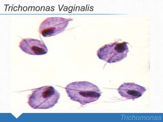 Trichomonas Vaginalis
Trichomonas
 