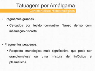 • Fragmentos grandes.
• Cercados por tecido conjuntivo fibroso denso com
inflamação discreta.
• Fragmentos pequenos.
• Resposta imunológica mais significativa, que pode ser
granulomatosa ou uma mistura de linfócitos e
plasmáticos.
Tatuagem por Amálgama
Características Histopatológicas
 