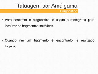 • Para confirmar o diagnóstico, é usada a radiografia para
localizar os fragmentos metálicos.
• Quando nenhum fragmento é encontrado, é realizado
biopsia.
Tatuagem por Amálgama
Diagnóstico
 