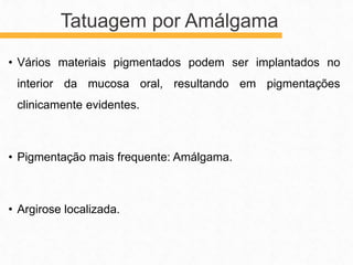 • Vários materiais pigmentados podem ser implantados no
interior da mucosa oral, resultando em pigmentações
clinicamente evidentes.
• Pigmentação mais frequente: Amálgama.
• Argirose localizada.
Tatuagem por Amálgama
 
