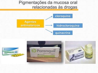 Pigmentações da mucosa oral
relacionadas às drogas
Agentes
antimaláricos
cloroquina
hidrocloroquina
quinacrina
 