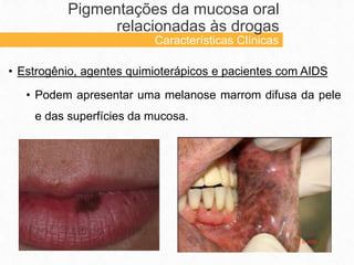 • Estrogênio, agentes quimioterápicos e pacientes com AIDS
• Podem apresentar uma melanose marrom difusa da pele
e das superfícies da mucosa.
Pigmentações da mucosa oral
relacionadas às drogas
Características Clínicas
 
