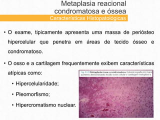 • O exame, tipicamente apresenta uma massa de periósteo
hipercelular que penetra em áreas de tecido ósseo e
condromatoso.
• O osso e a cartilagem frequentemente exibem características
atípicas como:
• Hipercelularidade;
• Pleomorfismo;
• Hipercromatismo nuclear.
Metaplasia reacional
condromatosa e óssea
Características Histopatológicas
 