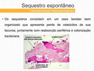 • Os sequestros consistem em um osso lamelar bem
organizado que apresenta perda de osteócitos de sua
lacunas, juntamente com reabsorção periférica e colonização
bacteriana.
Sequestro espontâneo
Características Histopatológicas
 