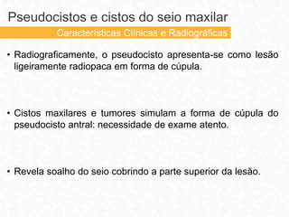 • Radiograficamente, o pseudocisto apresenta-se como lesão
ligeiramente radiopaca em forma de cúpula.
• Cistos maxilares e tumores simulam a forma de cúpula do
pseudocisto antral: necessidade de exame atento.
• Revela soalho do seio cobrindo a parte superior da lesão.
Pseudocistos e cistos do seio maxilar
Características Clínicas e Radiográficas
 