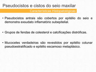 • Pseudocistos antrais são cobertos por epitélio do seio e
demonstra exsudato inflamatório subepitelial.
• Grupos de fendas de colesterol e calcificações distróficas.
• Mucoceles verdadeiras são revestidos por epitélio colunar
pseudoestratificado e epitélio escamoso metaplásico.
Pseudocistos e cistos do seio maxilar
Características Histopatológicas
 