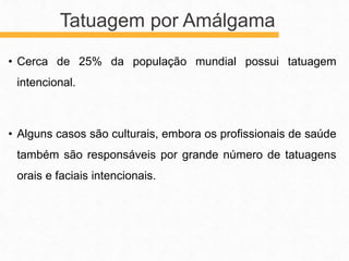 • Cerca de 25% da população mundial possui tatuagem
intencional.
• Alguns casos são culturais, embora os profissionais de saúde
também são responsáveis por grande número de tatuagens
orais e faciais intencionais.
Tatuagem por Amálgama
 