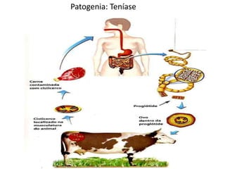 Patogenia: Teníase
 