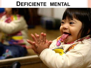 DEFICIENTE MENTAL
 