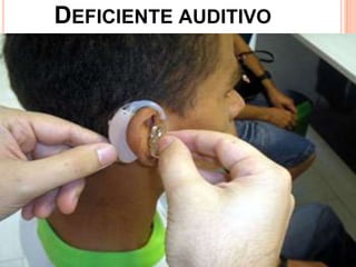 DEFICIENTE AUDITIVO
 