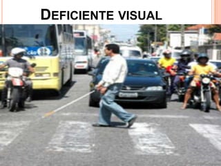 DEFICIENTE VISUAL
 