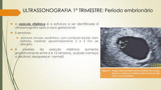 13
ULTRASSONOGRAFIA 1° TRIMESTRE: Período embrionário
 A vesícula vitelínica é a estrutura a ser identificada à
ultrassonografia após o saco gestacional;
 5 semanas:
 estrutura circular, excêntrica, com conteúdo líquido, bem
definida, medindo aproximadamente 3 a 4 mm de
diâmetro.
 A medida da vesícula vitelínica aumenta
gradativamente entre 6 e 12 semanas, quando começa
a declinar( desaparece- normal!)
 