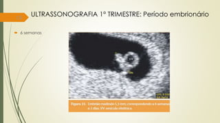 15
ULTRASSONOGRAFIA 1° TRIMESTRE: Período embrionário
 6 semanas
 