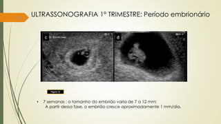 16
ULTRASSONOGRAFIA 1° TRIMESTRE: Período embrionário
Figura 12
• 7 semanas : o tamanho do embrião varia de 7 a 12 mm;
A partir dessa fase, o embrião cresce aproximadamente 1 mm/dia.
 