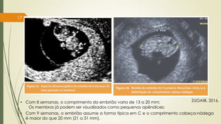 17
ZUGAIB, 2016.
• Com 8 semanas, o comprimento do embrião varia de 13 a 20 mm;
Os membros já podem ser visualizados como pequenos apêndices;
• Com 9 semanas, o embrião assume a forma típica em C e o comprimento cabeça-nádega
é maior do que 20 mm (21 a 31 mm).
 