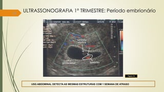 18
Figura 15
USG ABDOMINAL DETECTA AS MESMAS ESTRUTURAS COM 1 SEMANA DE ATRASO
ULTRASSONOGRAFIA 1° TRIMESTRE: Período embrionário
 