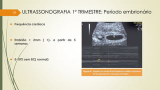  Frequência cardíaca
 Embrião > 2mm ( +)- a partir de 5
semanas
 5-10% sem BC( normal)
19 ULTRASSONOGRAFIA 1° TRIMESTRE: Período embrionário
 