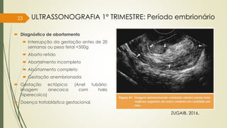  Diagnóstico de abortamento
 Interrupção da gestação antes de 20
semanas ou peso fetal <500g
 Aborto retido
 Abortamento incompleto
 Abortamento completo
 Gestação anembrionada
 Gestação ectópica; (Anel tubário:
imagem anecoica com halo
hiperecoico)
 Doença trofoblástica gestacional.
23
ZUGAIB, 2016.
ULTRASSONOGRAFIA 1° TRIMESTRE: Período embrionário
 