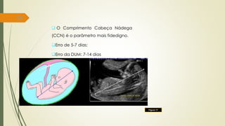 28
Figura 17
 O Comprimento Cabeça Nádega
(CCN) é o parâmetro mais fidedigno.
Erro de 5-7 dias;
Erro da DUM: 7-14 dias
 